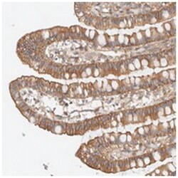 CEP112, Rabbit, Polyclonal Antibody, Abnova 100 &mu;L | Buy Online | Abnova Corporation | Fisher Scientific