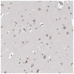 ZNF770, Rabbit, Polyclonal Antibody, Abnova 100 &mu;L | Buy Online | Abnova Corporation | Fisher Scientific