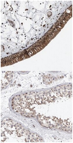 TDRD7, Rabbit, Polyclonal Antibody, Abnova 100&mu;L; Unlabeled:Antibodies,