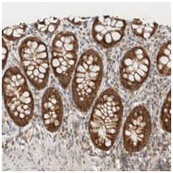 MRPL41 Rabbit anti-Human, Polyclonal Antibody, Abnova 100&mu;L; Unlabeled:Antibodies,