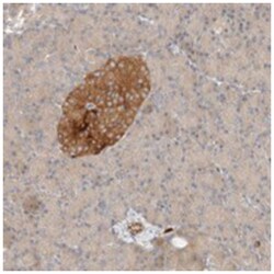SGSM2 Rabbit anti-Human, Polyclonal Antibody, Abnova 100 &mu;L | Buy Online | Abnova Corporation | Fisher Scientific