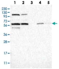 ZNF454, Rabbit, Polyclonal Antibody, Abnova 100 &mu;L | Buy Online | Abnova Corporation | Fisher Scientific