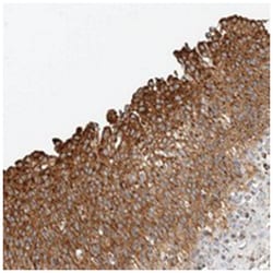 ZNF454, Rabbit, Polyclonal Antibody, Abnova 100 &mu;L | Buy Online | Abnova Corporation | Fisher Scientific