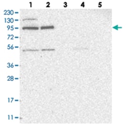 ZNF341 Rabbit anti-Human, Polyclonal Antibody, Abnova 100 &mu;L | Buy Online | Abnova Corporation | Fisher Scientific