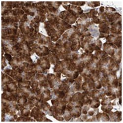 ZNF341 Rabbit anti-Human, Polyclonal Antibody, Abnova 100 &mu;L | Buy Online | Abnova Corporation | Fisher Scientific