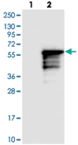 KLF17, Rabbit, Polyclonal Antibody, Abnova 100 &mu;L | Buy Online | Abnova Corporation | Fisher Scientific