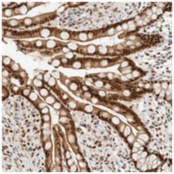 ZNF768, Rabbit, Polyclonal Antibody, Abnova 100&mu;L; Unlabeled:Antibodies,