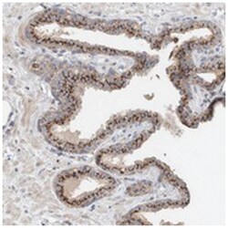 SLC38A10 Rabbit anti-Human, Polyclonal Antibody, Abnova 100 &mu;L | Buy Online | Abnova Corporation | Fisher Scientific