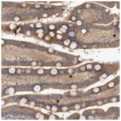 TARBP1 Rabbit anti-Human, Polyclonal Antibody, Abnova 100 &mu;L | Buy Online | Abnova Corporation | Fisher Scientific