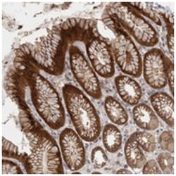 SAMD12, Rabbit, Polyclonal Antibody, Abnova 100 &mu;L | Buy Online | Abnova Corporation | Fisher Scientific