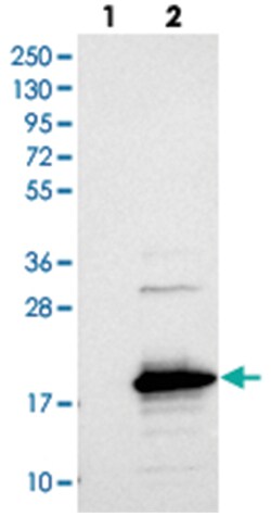 SAMD12, Rabbit, Polyclonal Antibody, Abnova 100 &mu;L | Buy Online | Abnova Corporation | Fisher Scientific