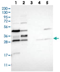 RRP15, Rabbit, Polyclonal Antibody, Abnova 100&mu;L; Unlabeled:Antibodies,