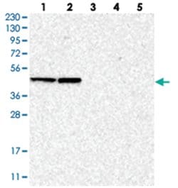 BXDC5, Rabbit, Polyclonal Antibody, Abnova 100&mu;L; Unlabeled:Antibodies,