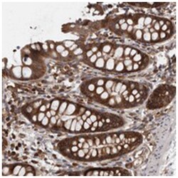 SMCR8 Rabbit anti-Human, Polyclonal Antibody, Abnova 100 &mu;L | Buy Online | Abnova Corporation | Fisher Scientific