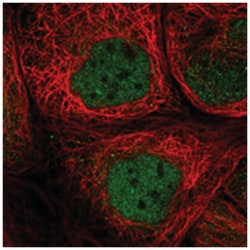 SMCR8 Rabbit anti-Human, Polyclonal Antibody, Abnova 100 &mu;L | Buy Online | Abnova Corporation | Fisher Scientific