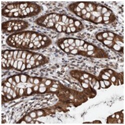 ENY2, Rabbit, Polyclonal Antibody, Abnova 100 &mu;L | Buy Online | Abnova Corporation | Fisher Scientific