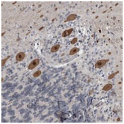 ZNF295, Rabbit, Polyclonal Antibody, Abnova 100&mu;L; Unlabeled:Antibodies,