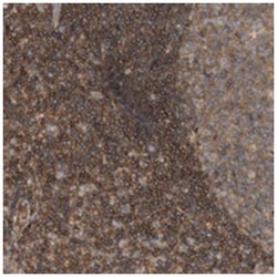 SCARA5 Rabbit anti-Human, Polyclonal Antibody, Abnova 100 &mu;L | Buy Online | Abnova Corporation | Fisher Scientific