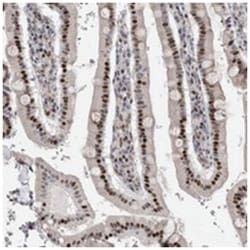 C8orf58 Rabbit anti-Human, Polyclonal Antibody, Abnova 100 &mu;L | Buy Online | Abnova Corporation | Fisher Scientific