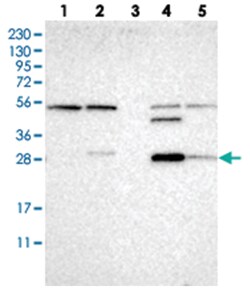 CA13 Rabbit anti-Human, Polyclonal Antibody, Abnova 100 &mu;L | Buy Online | Abnova Corporation | Fisher Scientific