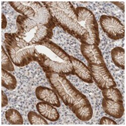CA13 Rabbit anti-Human, Polyclonal Antibody, Abnova 100 &mu;L | Buy Online | Abnova Corporation | Fisher Scientific