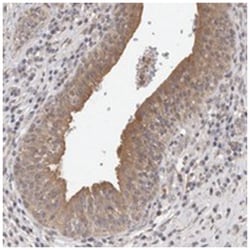 FHOD3 Rabbit anti-Human, Polyclonal Antibody, Abnova 100 &mu;L | Buy Online | Abnova Corporation | Fisher Scientific