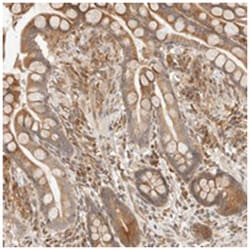 TACC1 Rabbit anti-Human, Polyclonal Antibody, Abnova 100 &mu;L | Buy Online | Abnova | Fisher Scientific