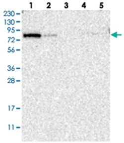 KLHL14, Rabbit, Polyclonal Antibody, Abnova 100 &mu;L | Buy Online | Abnova Corporation | Fisher Scientific