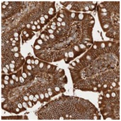 KLHL14, Rabbit, Polyclonal Antibody, Abnova 100 &mu;L | Buy Online | Abnova Corporation | Fisher Scientific