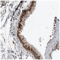 ZNF677 Rabbit anti-Human, Polyclonal Antibody, Abnova 100 &mu;L | Buy Online | Abnova Corporation | Fisher Scientific