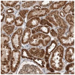 WDYHV1, Rabbit, Polyclonal Antibody, Abnova 100 &mu;L | Buy Online | Abnova Corporation | Fisher Scientific
