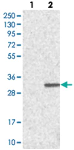 WDYHV1, Rabbit, Polyclonal Antibody, Abnova 100 &mu;L | Buy Online | Abnova Corporation | Fisher Scientific