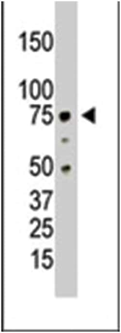 PRMT5 Rabbit anti-Human, Polyclonal Antibody, Abnova 400 &mu;L | Buy Online | Abnova Corporation | Fisher Scientific