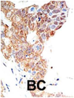 PRMT5 Rabbit anti-Human, Polyclonal Antibody, Abnova 400 &mu;L | Buy Online | Abnova Corporation | Fisher Scientific