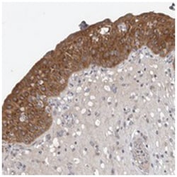 COL22A1, Rabbit, Polyclonal Antibody, Abnova 100 &mu;L | Buy Online | Abnova Corporation | Fisher Scientific