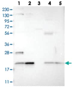 TMEM65, Rabbit, Polyclonal Antibody, Abnova 100&mu;L; Unlabeled:Antibodies,