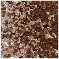 TMEM65, Rabbit, Polyclonal Antibody, Abnova 100&mu;L; Unlabeled:Antibodies,