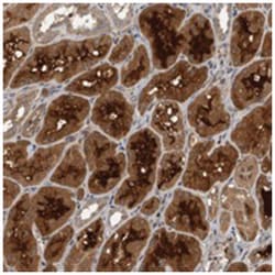 BTBD17, Rabbit, Polyclonal Antibody, Abnova 100 &mu;L | Buy Online | Abnova Corporation | Fisher Scientific