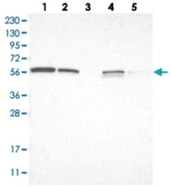 LETM2, Rabbit, Polyclonal Antibody, Abnova 100&mu;L; Unlabeled:Antibodies,