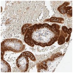 LETM2, Rabbit, Polyclonal Antibody, Abnova 100&mu;L; Unlabeled:Antibodies,