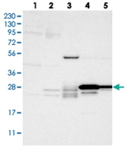 PEBP4, Rabbit, Polyclonal Antibody, Abnova 100 &mu;L | Buy Online | Abnova Corporation | Fisher Scientific