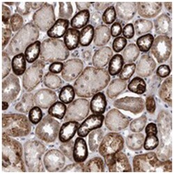 PEBP4, Rabbit, Polyclonal Antibody, Abnova 100 &mu;L | Buy Online | Abnova Corporation | Fisher Scientific