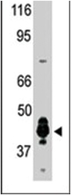 PRMT6, Rabbit, Polyclonal Antibody, Abnova 400 &mu;L | Buy Online | Abnova Corporation | Fisher Scientific