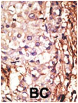 PRMT6, Rabbit, Polyclonal Antibody, Abnova 400 &mu;L | Buy Online | Abnova Corporation | Fisher Scientific