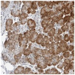 C8orf48 Rabbit anti-Human, Polyclonal Antibody, Abnova 100 &mu;L | Buy Online | Abnova Corporation | Fisher Scientific