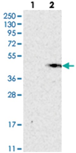 GGH Rabbit anti-Human, Polyclonal Antibody, Abnova 100&mu;L; Unlabeled:Antibodies,