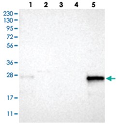 CNPY4 Rabbit anti-Human, Polyclonal Antibody, Abnova 100 &mu;L | Buy Online | Abnova Corporation | Fisher Scientific