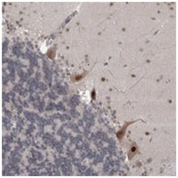 MTBP Rabbit anti-Human, Polyclonal Antibody, Abnova 100 &mu;L | Buy Online | Abnova Corporation | Fisher Scientific