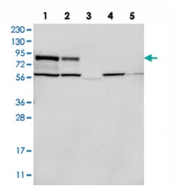 PLCD3, Rabbit, Polyclonal Antibody, Abnova 100 &mu;L | Buy Online | Abnova Corporation | Fisher Scientific