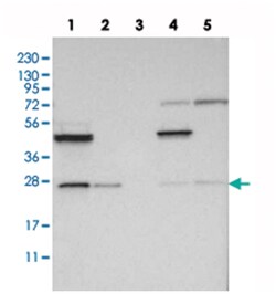 RP5-1000E104 Rabbit anti-Human, Polyclonal Antibody, Abnova 100&mu;L; Unlabeled:Antibodies,